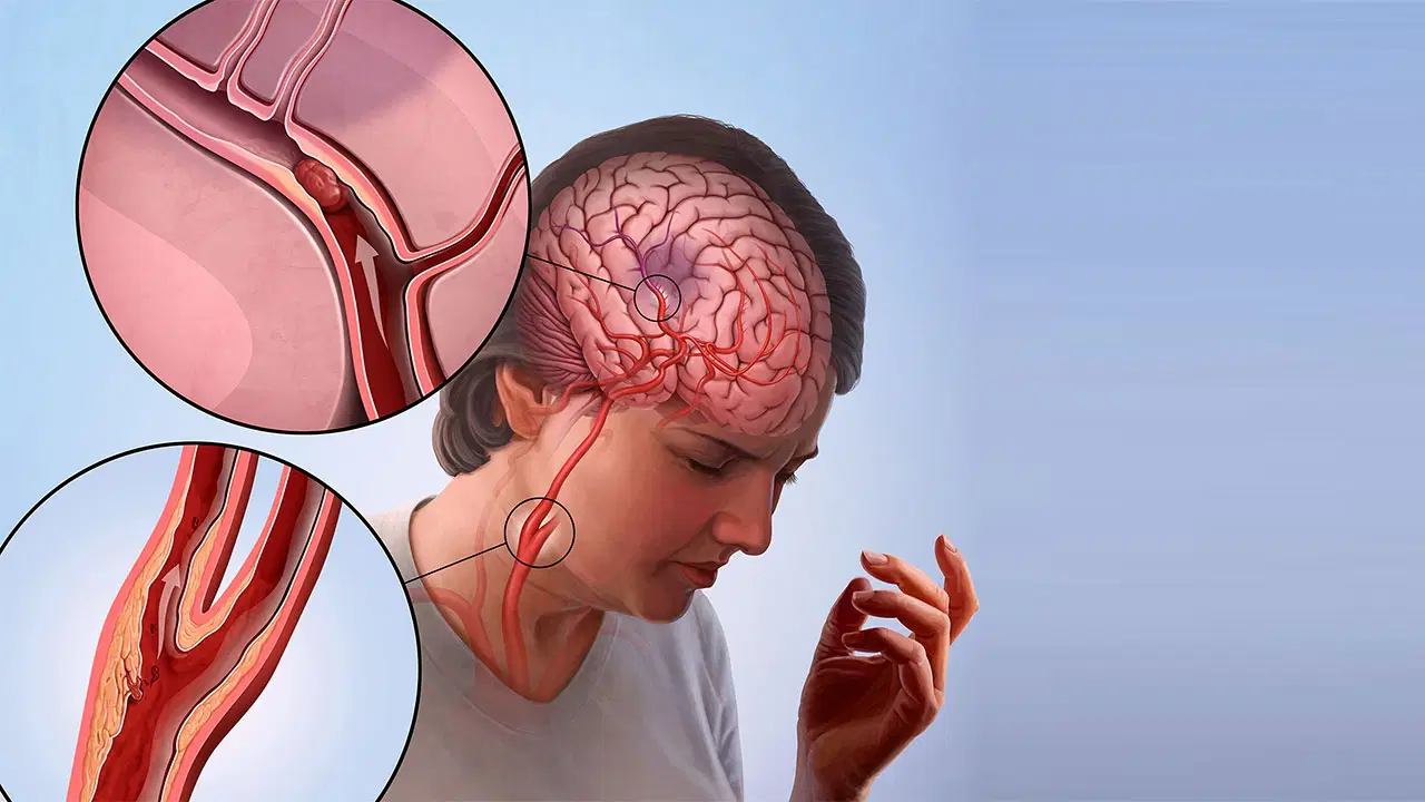 turkiyede bu sebepten dolayi her yil 45 bin insan oluyor mixykGTN