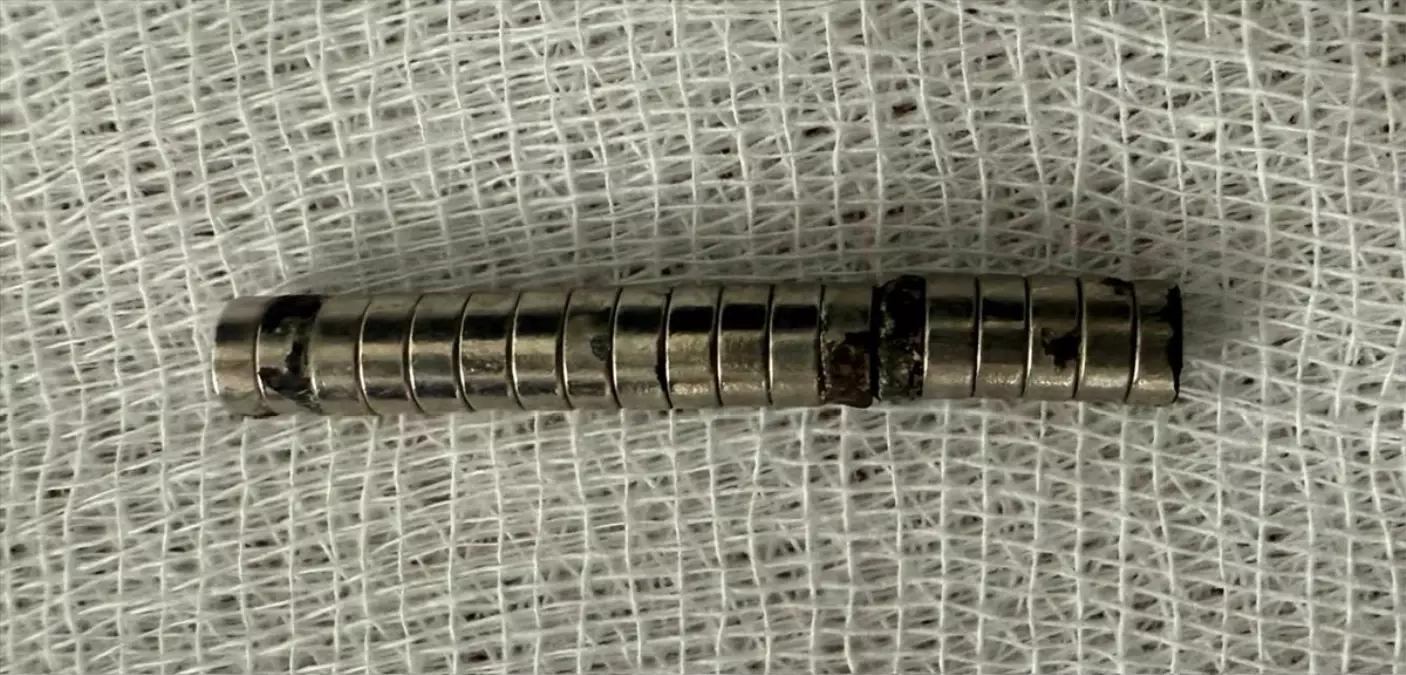 elazigda miknatis yutan cocuk kurtarildi gpGg3up4